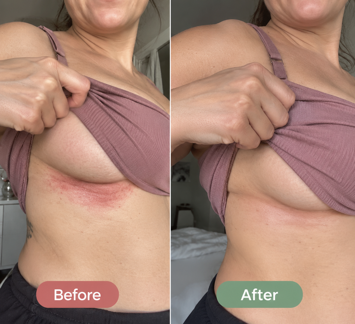 Woman using a practical skin-fold care routine