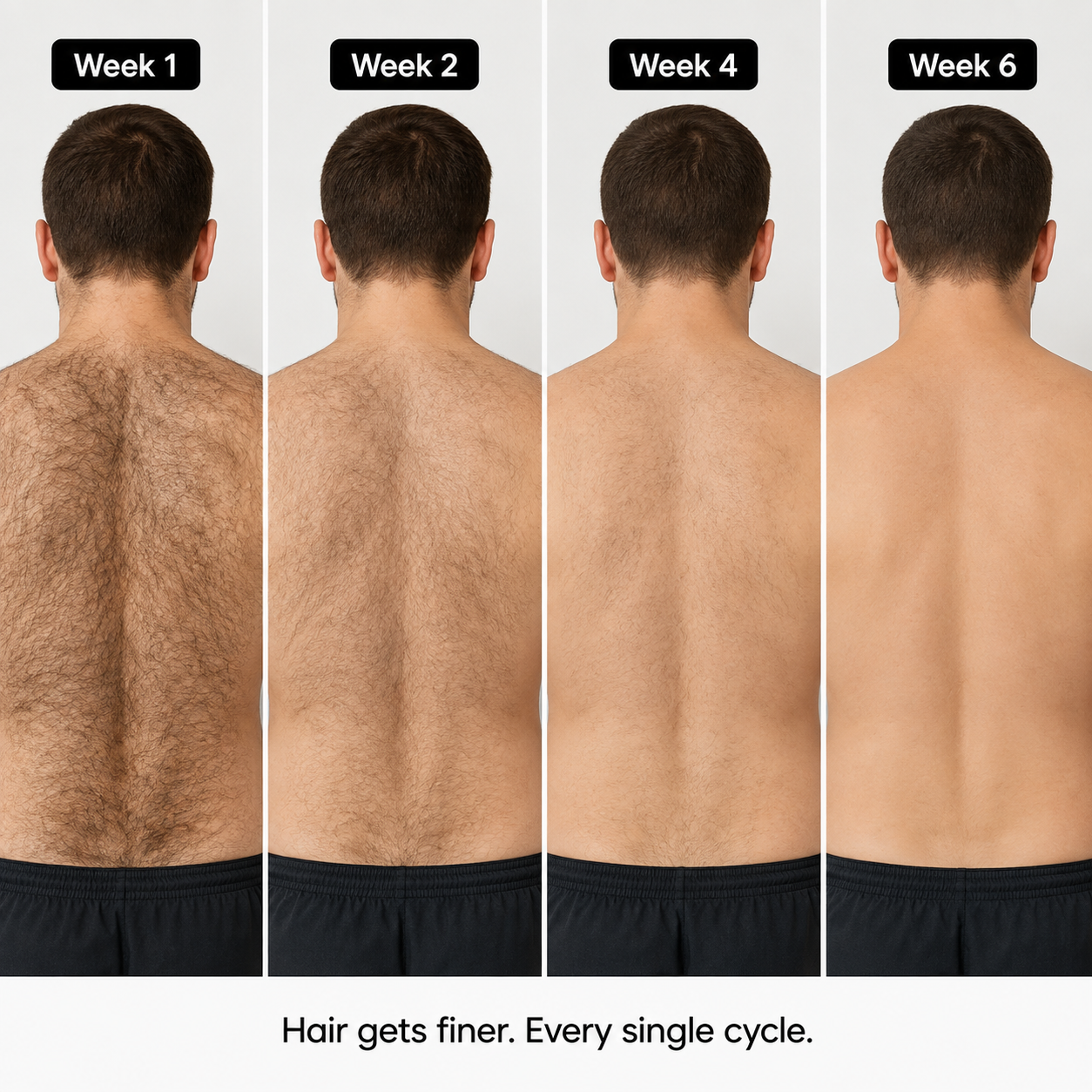 Five Drops. Two Times a Day. One Area at a Time.