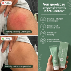 Kare Cream – Pflege für beanspruchte Hautfalten