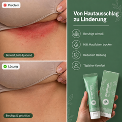 Kare Cream – Pflege für beanspruchte Hautfalten