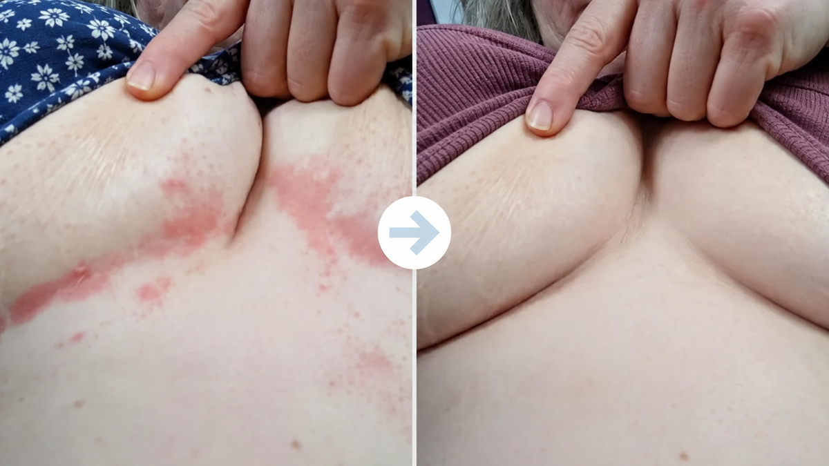 Make skin-fold comfort part of your everyday routine